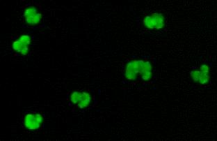Dépistage des ANCA Le dépistage se fait par immunofluorescence sur neutrophiles humains fixés à l éthanol.