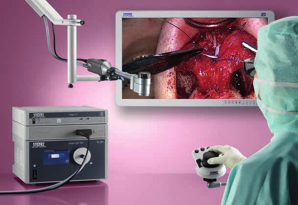 VITOM 3D Visualisation 3D en ORL et en chirurgie ouverte Le système VITOM 3D sert à visualiser les interventions de micro chirurgie et de chirurgie ouverte dans de nombreuses disciplines médicales.
