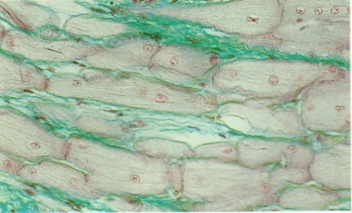 Cellules nodales (pour info) Très grandes cellules peu de cytosquelette Conjonctif lâche Ces cellules sont spécialisées dans la conduction de l'excitation (cellules de purkinje).