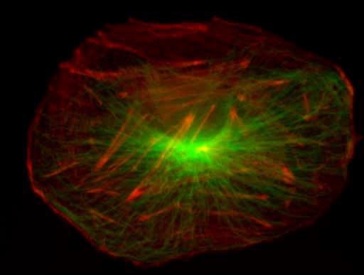 microfilaments d actine En bleu : filaments