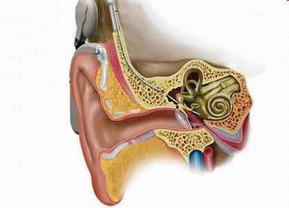 Les pathologies de l oreille interne Les