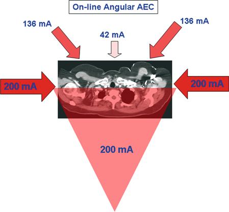 Angular AEC CARE Dose : «on-line AEC» Détermine l atténuation du faisceau en fonction des projections