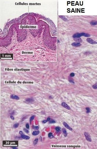 B- Comparaison d'une coupe de peau saine et d'une coupe de la peau infectée de Chloé : Photographie d une coupe transversale de peau saine, observée au microscope optique.