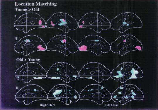 REGIONS ACTIVES POUR LA LOCALISATION DE POINTS Activation plus importante du cortex préfrontal, des cortex pariétaux médian et inférieur chez les Âgés. Grady, Maisog, Horwitz.