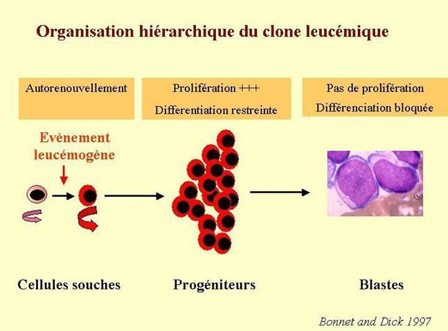 I- Définition : - Hémopathies malignes caractérisés par l expansion clonale dans la moelle osseuse de précurseurs des cellules sanguines bloqués à un stade précoce de leur différenciation (immatures