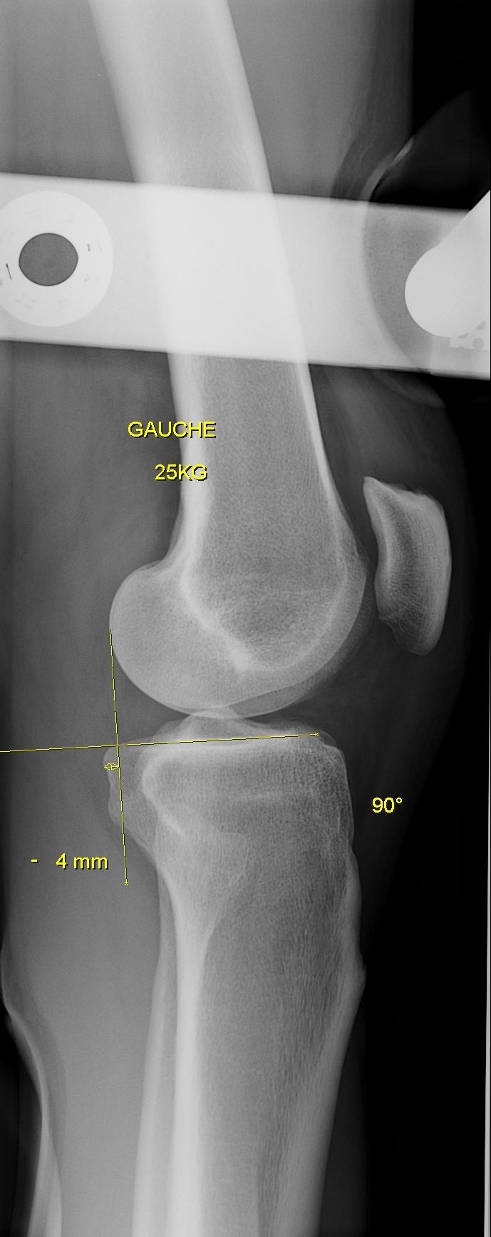 Ligamentaire.