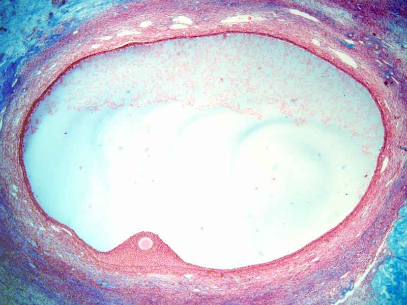 5- Le follicule pré ovulatoire (de De Graff) Au terne du développement du foll. tertiaire Diamètre: 16 à 20mm Ovocyte de diamètre de 120 µm, riche en organites intracellulaires (mito.