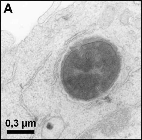 Staphylocoques dorés à l intérieur du cytoplasme d un macrophage1h après phagocytose Staphylocoques dorés à l intérieur du cytoplasme d un macrophage24h après phagocytose Photographie prises
