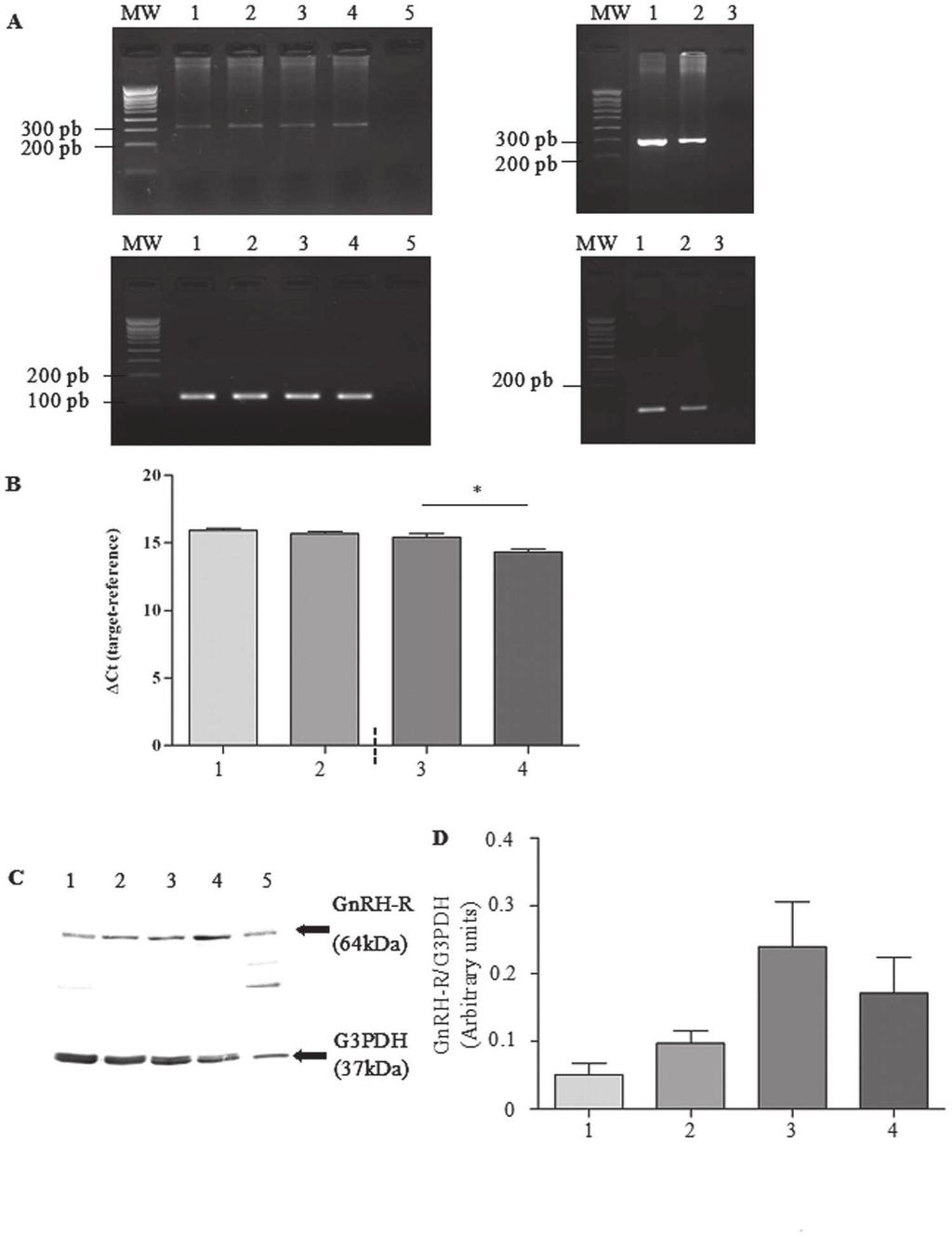 GnRH Improves Chloride Transport in CF Cells Figure 1. Basal mrna and protein expression of GnRH-R. A.