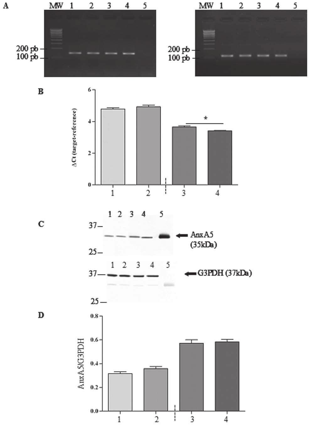 GnRH Improves Chloride Transport in CF Cells to establish the baseline (k peak-k basal, min 1 ).