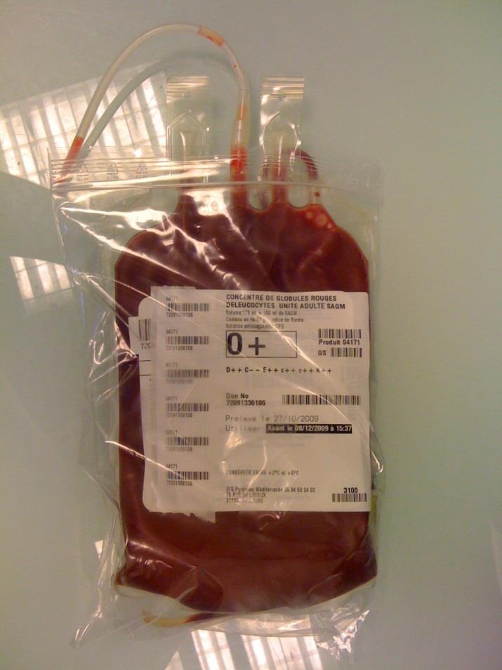 2. Le contrôle ultime pré transfusionnel (test ultime) Coller une