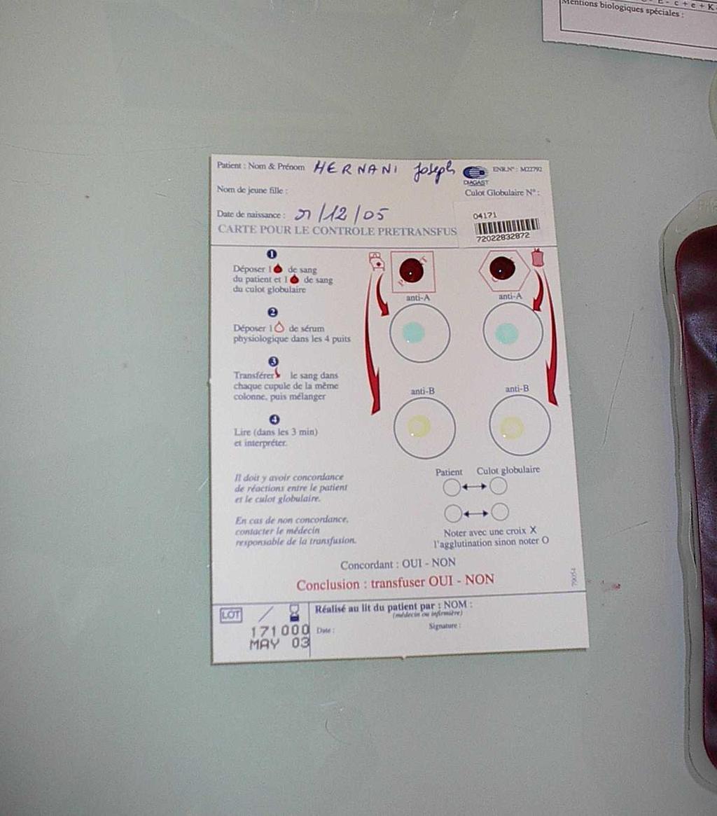 2. Le contrôle ultime pré transfusionnel (test ultime) Déposer le sang du