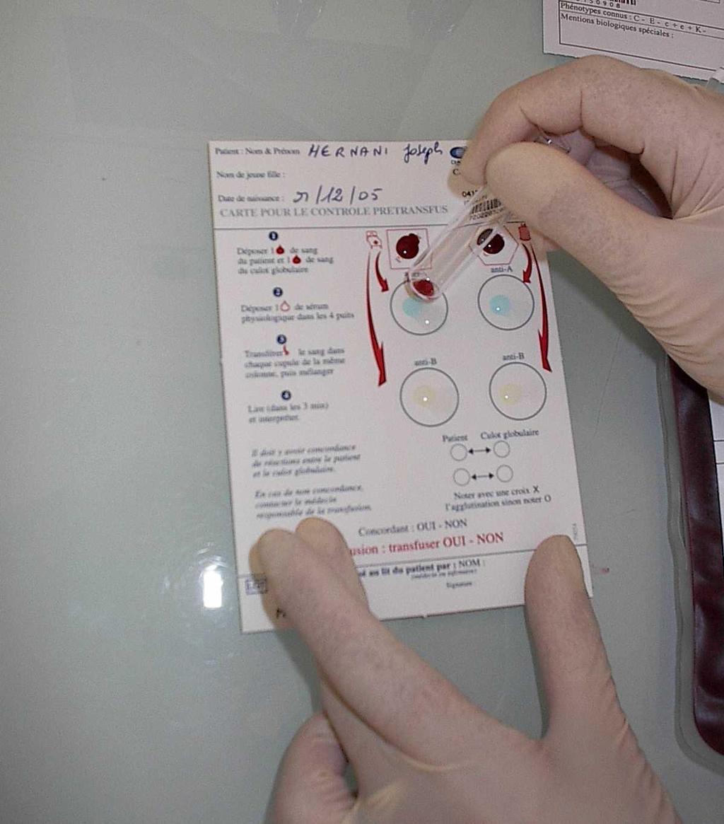 2. Le contrôle ultime pré transfusionnel (test ultime) Prélever un peu de sang du receveur (à