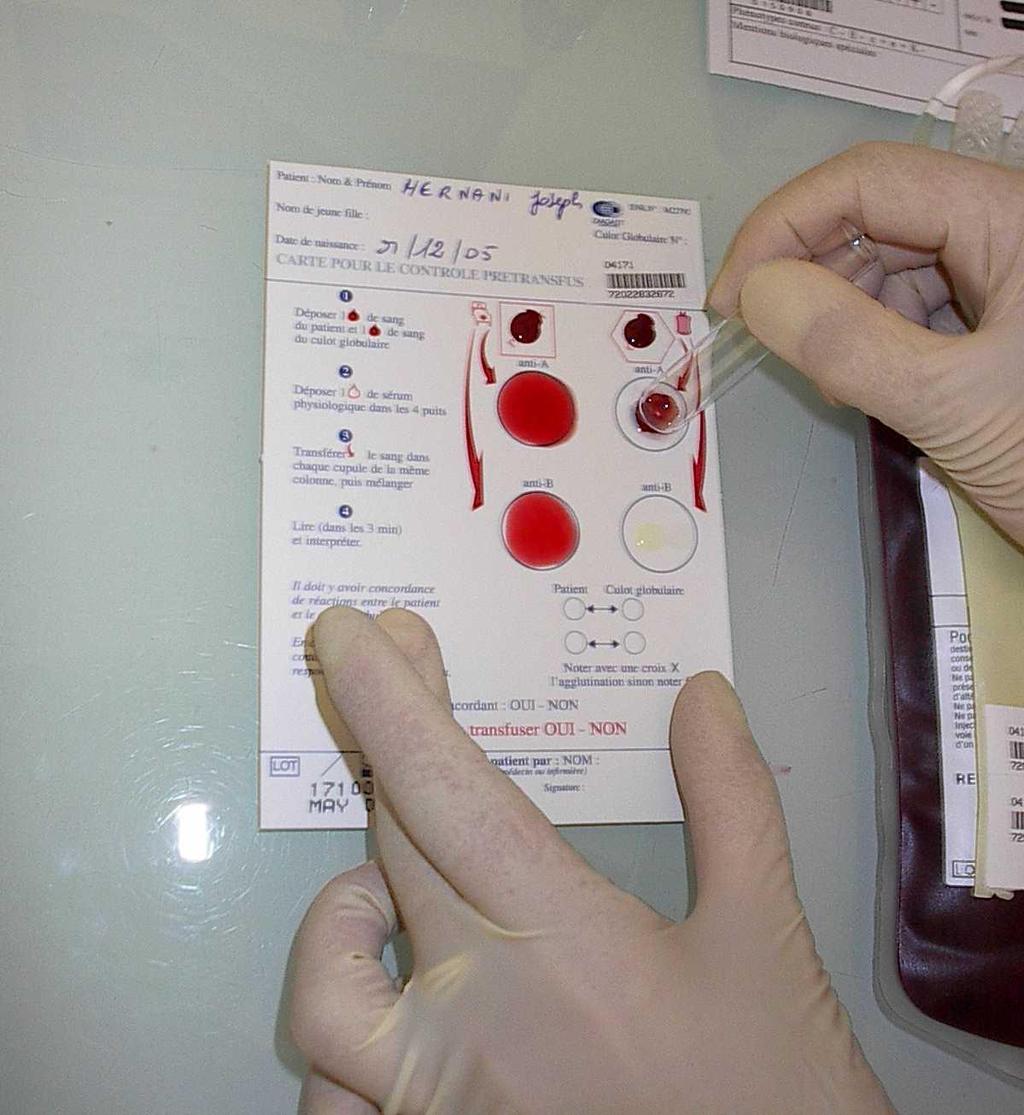 2. Le contrôle ultime pré transfusionnel (test
