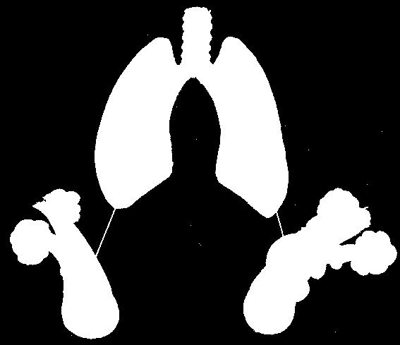 crise d asthme Durant une crise d asthme, l ouverture des bronches est réduite, ce qui provoque souvent une