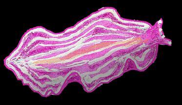 Echinodermes Les ascidies Poissons (hydraires, ascidies, éponges, bryozoaires, vers, algues...). Les natices se régalent des bivalves, et sont elles mêmes la proie d autres gastéropodes.