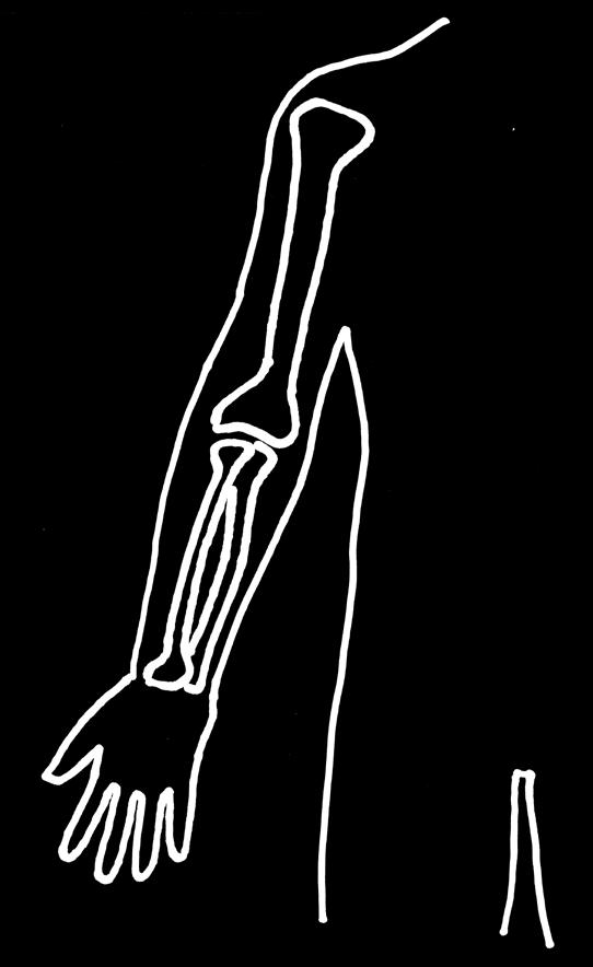 c) Un élève a dessiné un schéma des os du bras et de l'avant-bras. Voici son schéma incomplet. Il veut y dessiner les muscles.