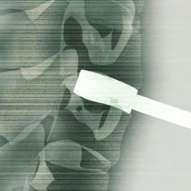 et hauteur) soit orienté vers la tête du patient. L implant d essai peut être légèrement impacté à l aide d un petit marteau*.