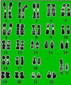 Un nombre anormal de chromosomes créé chez les personnes atteintes des caractères différents.