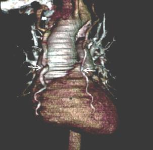 Echographie cardiaque +/- Si cardiopathie,