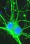 Des milliards de ces synapses contribuent au traitement d'un seul
