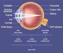 L'uvéite antérieure (relative principalement à l'iris et/ou au corps ciliaire) se manifeste par une douleur oculaire intense, une photophobie (peur de la lumière) et/ou une rougeur oculaire et/ou