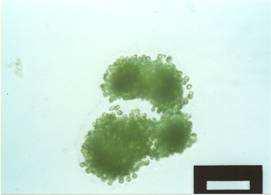 Qu est est-ce qu une une cyanobactérie?